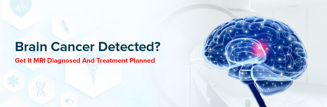 Brain Cancer Detected? Get It MRI Diagnosed And Treatment Planned